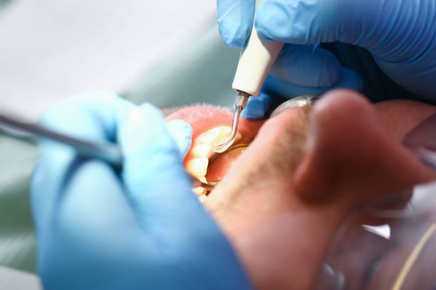 Best Mobile Emergency Dentist in Grand Rapids, MI